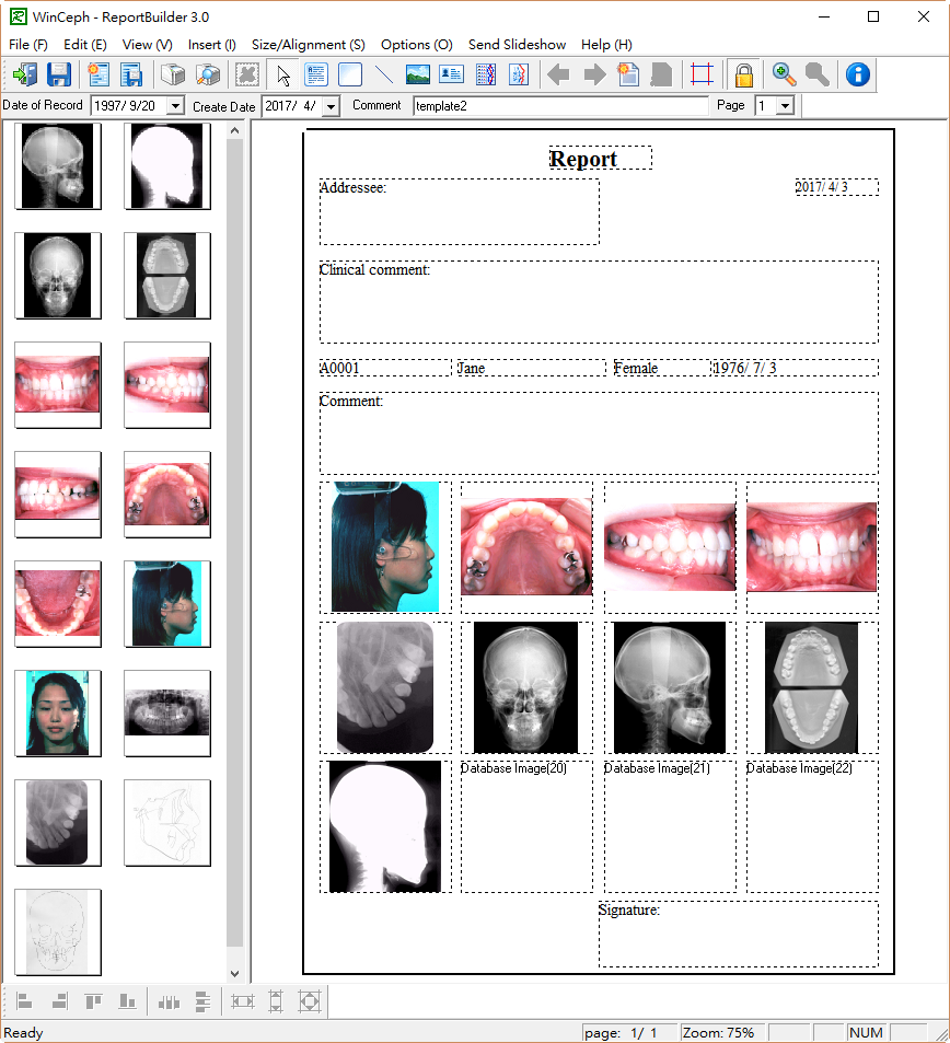 Superimpose Cephalogram images