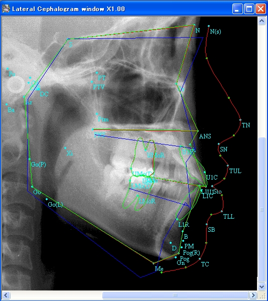 Superimpose Cephalogram images